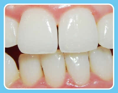 After Image