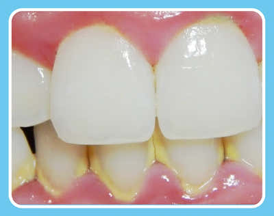 Before Image