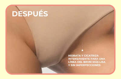 After Image